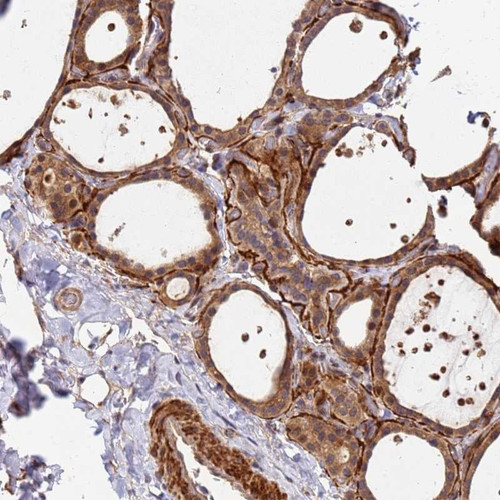 Immunohistochemical staining of human thyroid gland shows moderate cytoplasmic positivity in glandular cells.