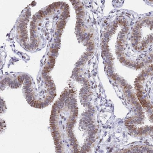 Immunohistochemical staining of human fallopian tube shows moderate nuclear positivity in glandular cells.