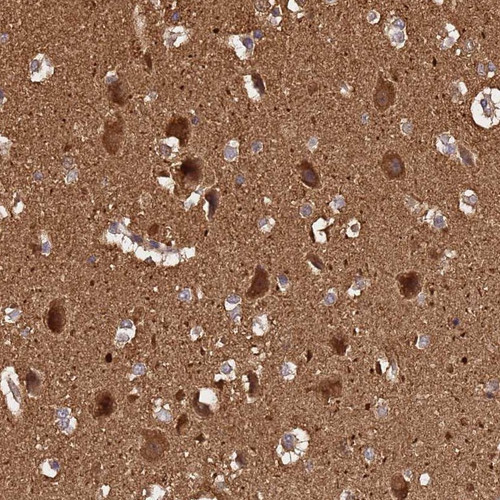 Immunohistochemical staining of human cerebral cortex shows distinct positivity in neurons and neuropil.
