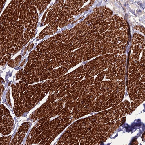Immunohistochemical staining of human smooth muscle shows strong cytoplasmic positivity in smooth muscle cells.