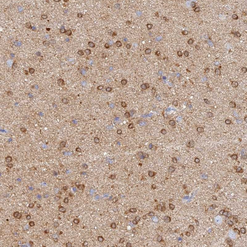 Immunohistochemical staining of human cerebral cortex shows moderate cytoplasmic positivity in glial cells.