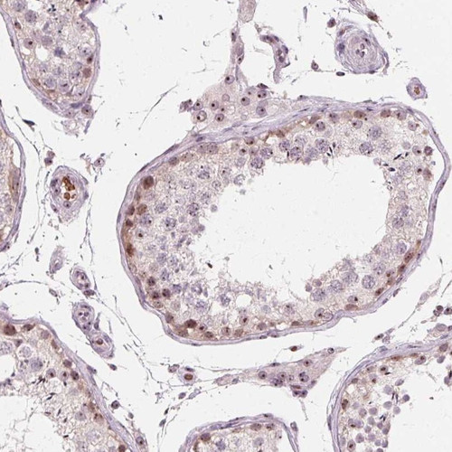 Immunohistochemical staining of human testis shows moderate nucleolar positivity in subset of cells in seminiferous ducts and Leydig cells.