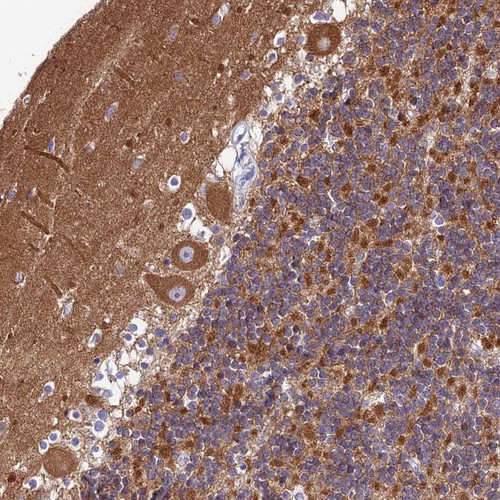 Immunohistochemical staining of human cerebellum shows strong cytoplasmic positivity in Purkinje cells.