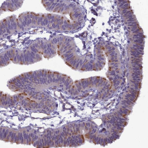 Immunohistochemical staining of human fallopian tube shows moderate membranous positivity in glandular cells.
