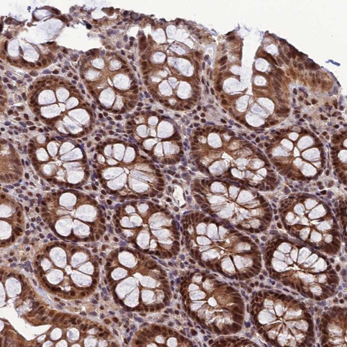 Immunohistochemical staining of human colon shows strong nuclear and cytoplasmic positivity in glandular cells.