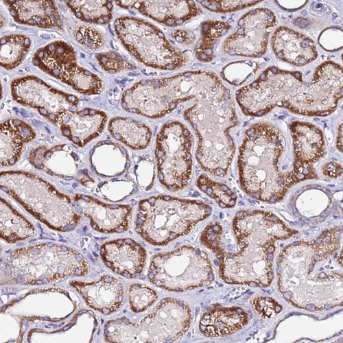 Immunohistochemical staining of human kidney shows strong cytoplasmic positivity in cells in tubules.
