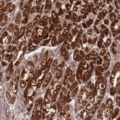 Immunohistochemical staining of human stomach, upper shows strong cytoplasmic positivity in glandular cells.