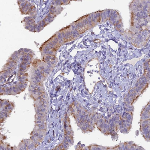 Immunohistochemical staining of human fallopian tube shows strong membranous positivity in ciliated cells.