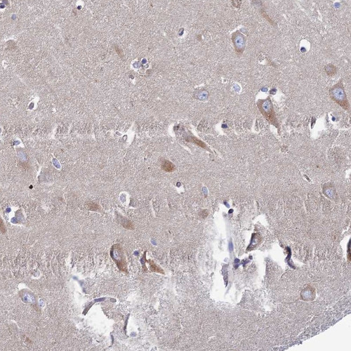 Immunohistochemical staining of human hippocampus shows moderate cytoplasmic positivity in neuronal cells.