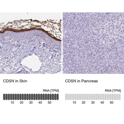 Immunohistochemistry analysis in human skin and pancreas tissues using HPA044730 antibody. Corresponding CDSN RNA-seq data are presented for the same tissues.
