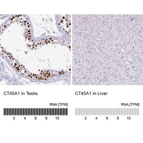 Immunohistochemistry analysis in human testis and liver tissues using HPA044735 antibody. Corresponding CT45A1 RNA-seq data are presented for the same tissues.