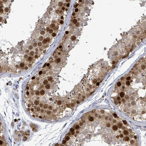 Immunohistochemical staining of human testis shows strong nuclear positivity in cells of seminiferus ducts.