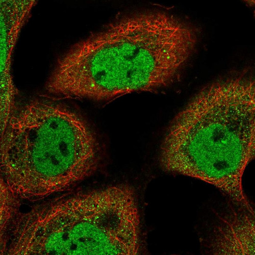 Immunofluorescent staining of human cell line A-431 shows localization to nucleoplasm & vesicles.