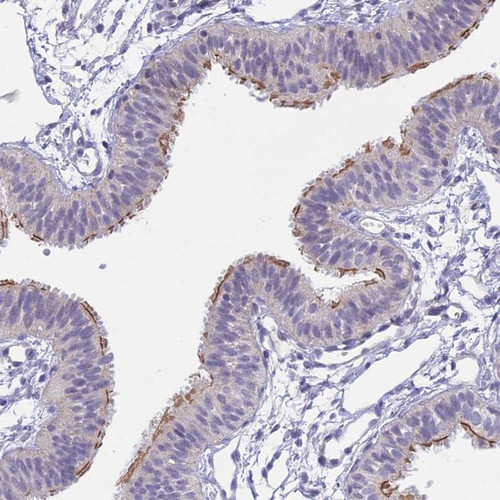 Immunohistochemical staining of human fallopian tube shows strong membranous positivity in glandular cells.