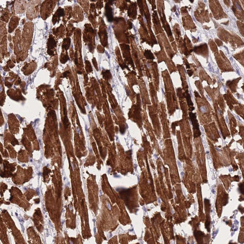Immunohistochemical staining of human heart muscle shows strong cytoplasmic positivity in myocytes.