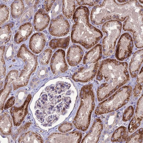 Immunohistochemical staining of human kidney shows strong cytoplasmic positivity in cells in tubules.