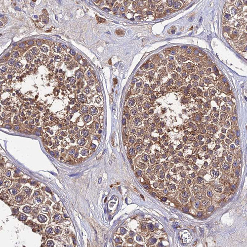 Immunohistochemical staining of human testis shows moderate cytoplasmic positivity in cells in seminiferous ducts.