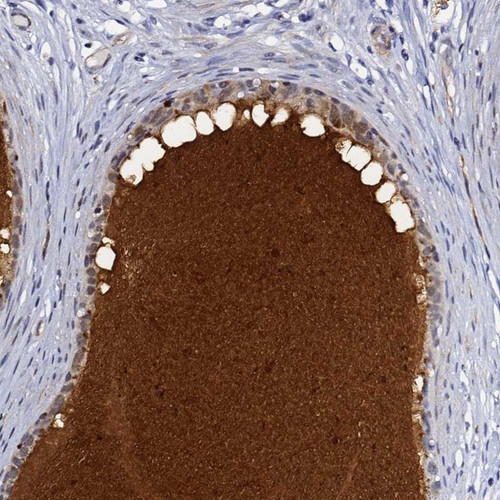 Immunohistochemical staining of human epididymis shows extracellular positivity in glandular cells.