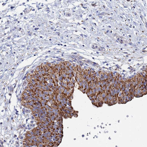 Immunohistochemical staining of human urinary bladder shows strong granular cytoplasmic positivity in urothelial cells.