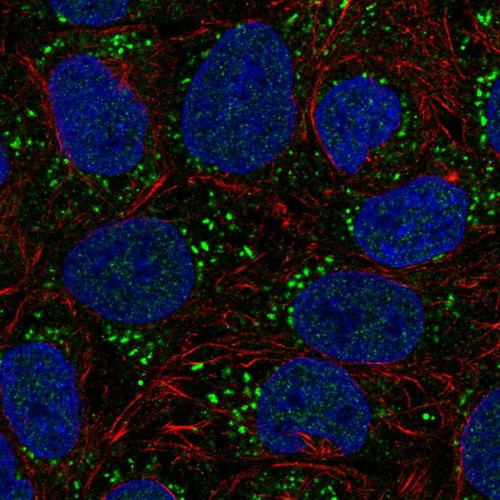 Immunofluorescent staining of human cell line RT4 shows localization to vesicles.