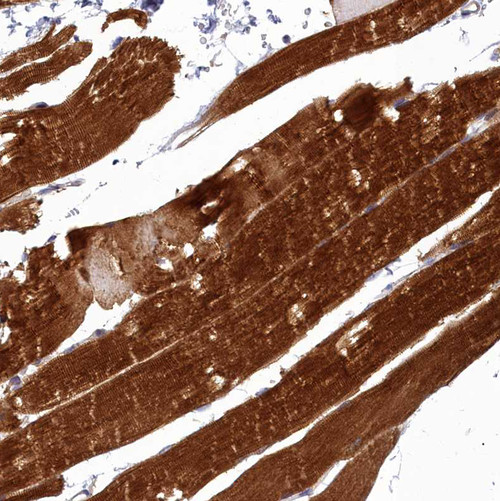 Immunohistochemical staining of human skeletal muscle shows strong cytoplasmic positivity in myocytes.