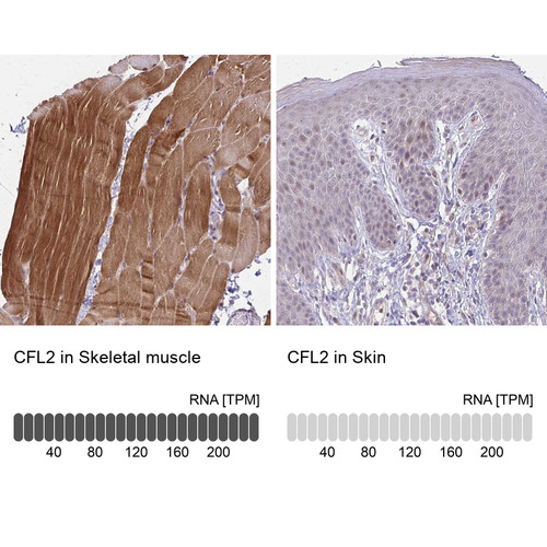 Immunohistochemistry analysis in human skeletal muscle and skin tissues using HPA045599 antibody. Corresponding CFL2 RNA-seq data are presented for the same tissues.