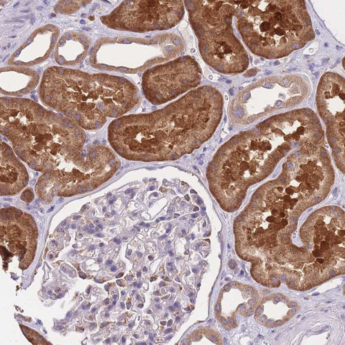 Immunohistochemical staining of human kidney shows strong cytoplasmic positivity in cells in tubules.