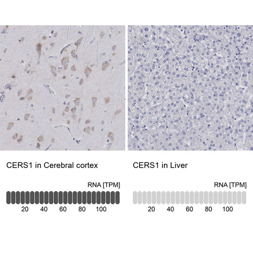 Immunohistochemistry analysis in human cerebral cortex and liver tissues using HPA045724 antibody. Corresponding CERS1 RNA-seq data are presented for the same tissues.