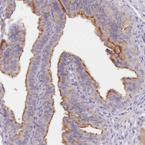 Immunohistochemical staining of human fallopian tube shows moderate positivity in ciliated cells.