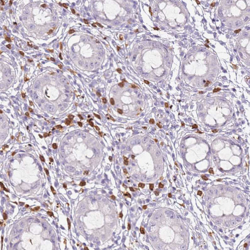 Immunohistochemical staining of human rectum shows strong cytoplasmic positivity in leukocytes.