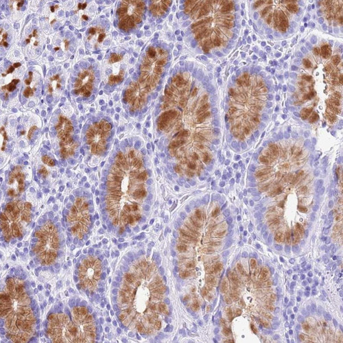Immunohistochemical staining of human stomach, upper shows strong cytoplasmic positivity in glandular cells.