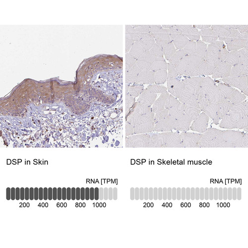 Immunohistochemistry analysis in human skin and skeletal muscle tissues using HPA045840 antibody. Corresponding DSP RNA-seq data are presented for the same tissues.