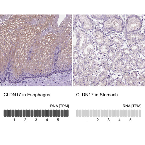 Immunohistochemistry analysis in human esophagus and stomach tissues using Anti-CLDN17 antibody. Corresponding CLDN17 RNA-seq data are presented for the same tissues.