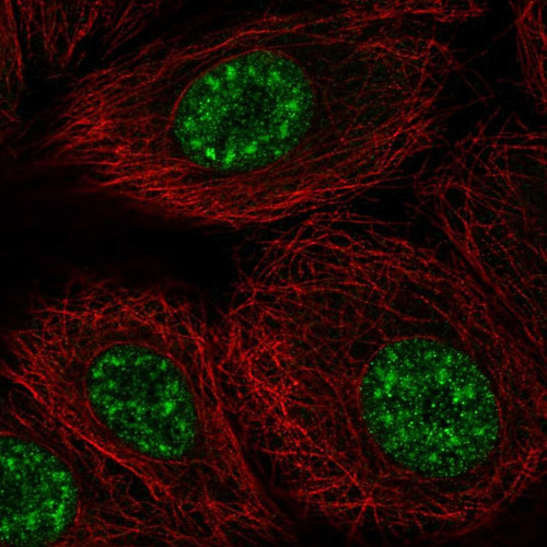 Immunofluorescent staining of human cell line MCF7 shows localization to nuclear speckles.