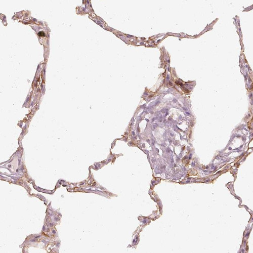Immunohistochemical staining of human lung shows moderate membranous positivity in pneumocytes.