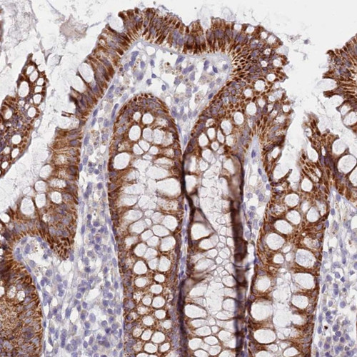 Immunohistochemical staining of human colon shows strong cytoplasmic positivity with a granular pattern in glandular cells.