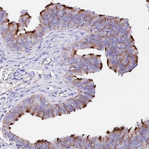 Immunohistochemical staining of human fallopian tube shows strong positivity in cilia.