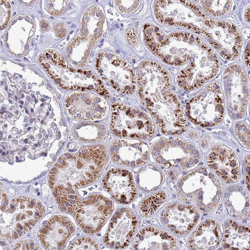 Immunohistochemical staining of human kidney shows strong cytoplasmic positivity in cells in tubules.