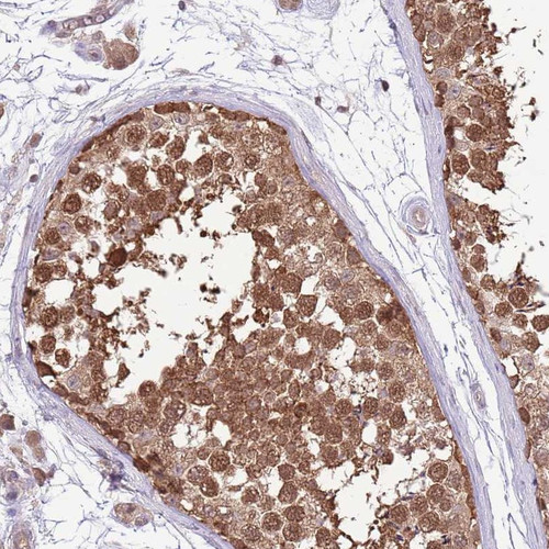 Immunohistochemical staining of human testis shows strong cytoplasmic and nuclear positivity in cells in seminiferus ducts.