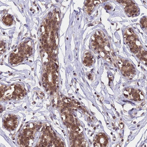Immunohistochemical staining of human breast shows moderate cytoplasmic and nuclear positivity in glandular cell.