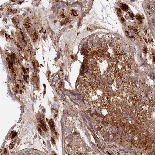 Immunohistochemical staining of human testis shows strong cytoplasmic positivity in cells in seminiferus ducts and Leydig cells.