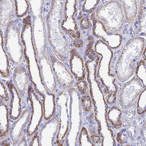 Immunohistochemical staining of human kidney shows strong cytoplasmic positivity in cells in tubules.