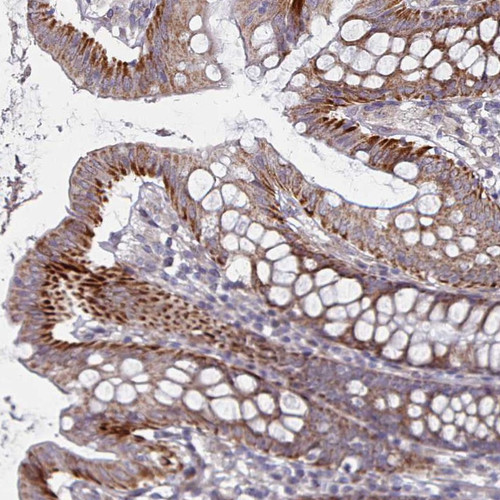 Immunohistochemical staining of human colon shows strong cytoplasmic positivity in glandular cells.