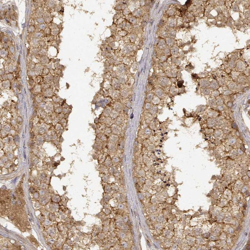 Immunohistochemical staining of human testis shows moderate cytoplasmic positivity in cells in seminiferous ducts and Leydig cells.