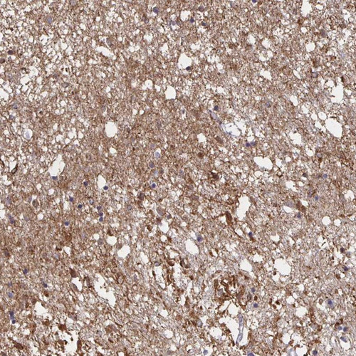 Immunohistochemical staining of human caudate shows distinct positivity.