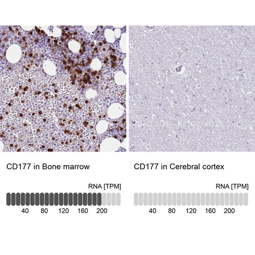 Immunohistochemistry analysis in human bone marrow and cerebral cortex tissues using Anti-CD177 antibody. Corresponding CD177 RNA-seq data are presented for the same tissues.