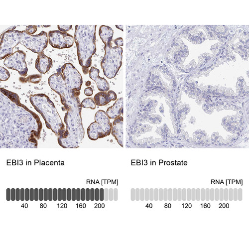 Immunohistochemistry analysis in human placenta and prostate tissues using HPA046635 antibody. Corresponding EBI3 RNA-seq data are presented for the same tissues.