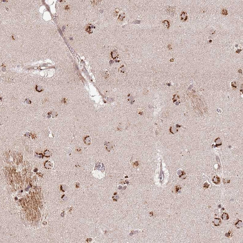 Immunohistochemical staining of human caudate shows strong cytoplasmic positivity in neuronal cells.