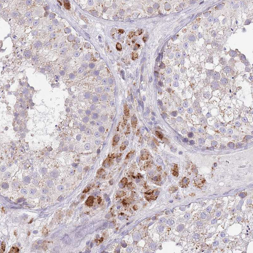 Immunohistochemical staining of human stomach, upper shows strong cytoplasmic positivity in glandular cells.