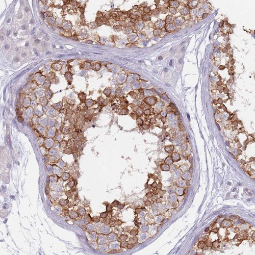 Immunohistochemical staining of human testis shows strong cytoplasmic positivity in cells in seminiferus ducts.